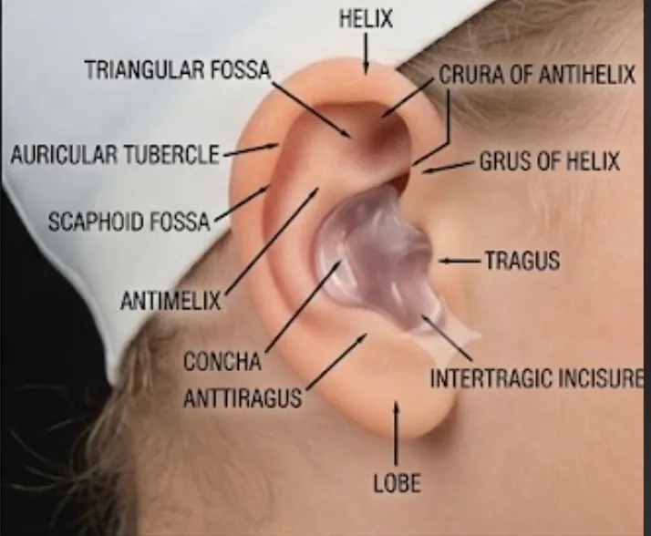 Diagram of a molded plug sealing the ear canal, with the parts of the ear labeled