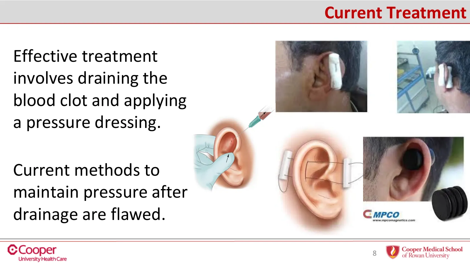 Slide 8 of 32: Current treatment