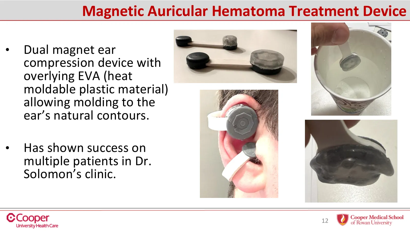 Slide 12 of 32: Magnetic auricular hematoma treatment device
